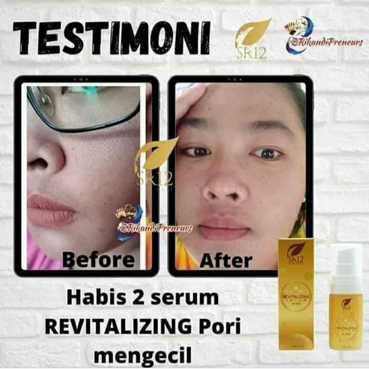 Ini Habis 2 botol serum Revitalizing ya...Bukan sekali usap doang...Karena perawatan itu bukan seperti iklan di TV, sekali usap langsung cling🙃😬Perawatan itu Harus Rutin, telaten dan sabar itu kuncinya❤️#serum_revitalizing#samarkan_matapanda#kecilkan_poriporiReady stockOrder/konsultasi (free)WA/Telegram👉0821-5799-8873AGEN RESMI SR12 HERBAL SKINCARE BALIKPAPAN, KAL-TIMMampir yuks 👇shopee.co.id/agenresmisr12Atautokopedia.com/sr12balikpapanBisa pakai voucher free ongkir dan bisa COD juga lo... dapatkan harga terbaik sesuai katalog dan promo menarik lainnya GERCEP🎉🎉🎉