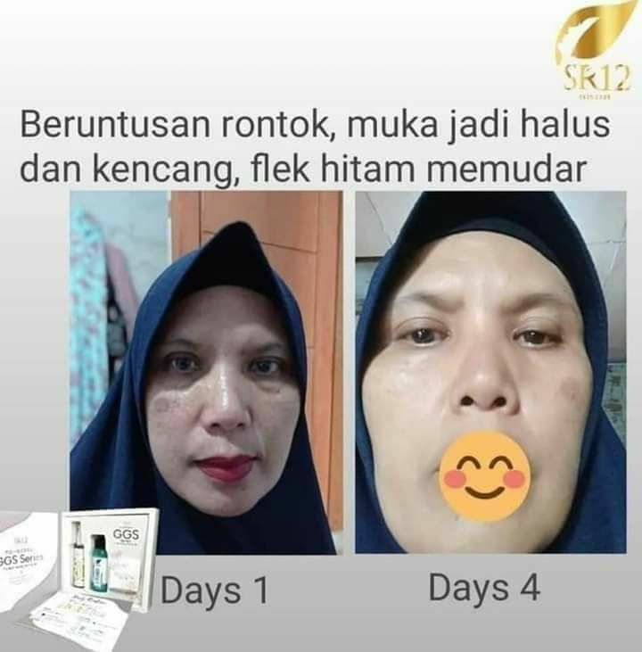 Semakin tua umur nya, makin kelihatan awet muda wajah nya😁🥰Lihatlah kulit wajahnya👆 yang semula putih pucat ada flek Hitam nya juga...sekarang jadi semakin cerah alami lo... flek hitam nya pun tampak memudar🤗🤩👍Siapakah tersangka nya?? Ya GGS series lah...🥰 Glow Glass Skin Gel yang kaya manfaat, kaya zat aktif pencerah, anti aging dan  anti oksidannya.Ready stock🤩Order atau konsultasi (Free)WA/Telegram👉0821-5799-8873AGEN RESMI SR12 HERBAL SKINCARE BALIKPAPAN, KAL-TIMMampir yuks ke shopeeku👇Jangan lupa follow ya🥰shopee.co.id/agenresmisr12Atau tokpedku👇tokopedia.com/sr12balikpapan________Dapatkan harga terbaik sesuai katalog, bisa pakai voucher free ongkir dan bisa COD juga lo...GERCEEEP🎉🎉🎉