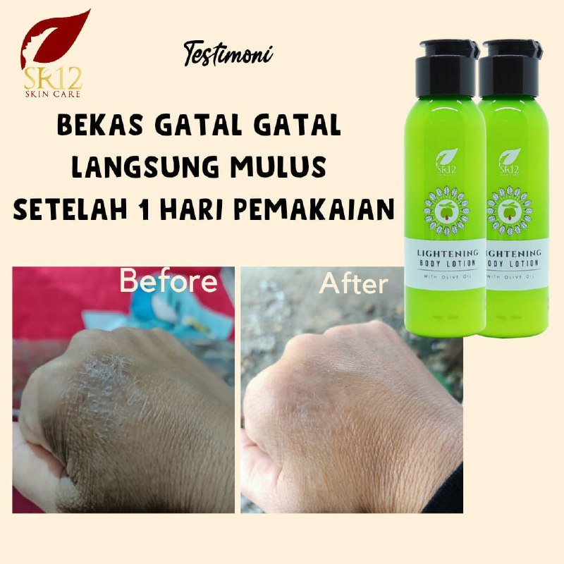 😱😱😱 keren bingiiiit...itu lah kulit kita berbeda-beda ya...beda juga kecepatan respon nya. Tapi yang pasti SR12 itu memang uwowwwwww🤩 masyaAllah🥰💐#LighteningBodyLotionSR12#HandBody_Untuk_SiangSR12#WhiteningBodyLotionSR12#HandBody_Untuk_MalamSR12Ready Stock🤩🤩🤩WA/Telegram👉0821-5799-8873AGEN RESMI SR12 HERBAL SKINCARE BALIKPAPAN, KAL-TIMAda di shopeeku kok 👇👇👇shopee.co.id/agenresmisr12(Dapatkan harga terbaik sesuai katalog, bisa pakai voucher free ongkir lo ..and bisa COD juga lo...🎉🎉🎉)Juga tokpedku👇👇👇tokopedia.com/sr12balikpapan